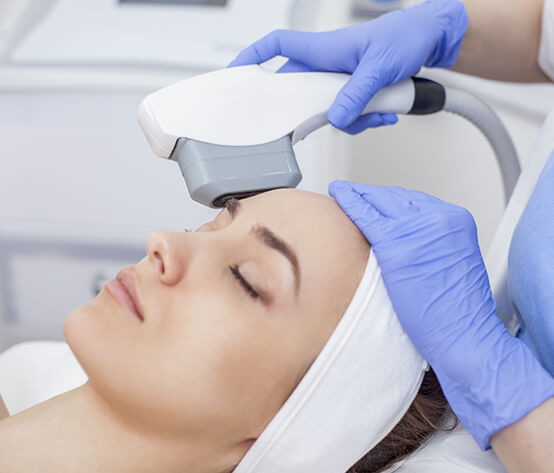 IPL Photofacial Treatment in Longmont, CO