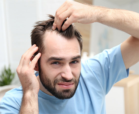 Man with hair loss problem