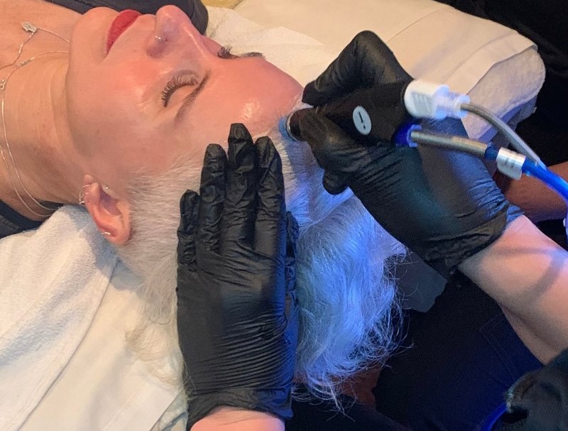 Patrice vonMetzger having an HydroFacial Keravive Treatment