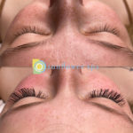 Lash Extensions Before and After at Sunflower Spa