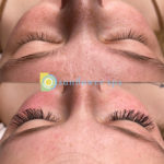 Classic Lash Extensions