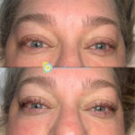 Lash Lift and Tint Before and After at Sunflower Spa