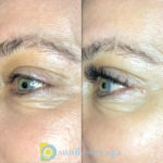 Lash Extensions Before and After at Sunflower Spa