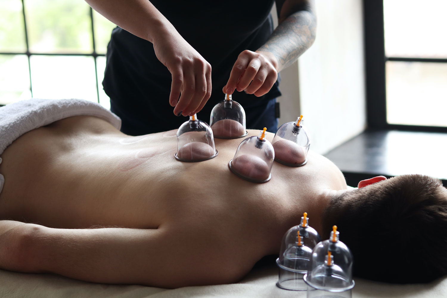 Man having a cupping  therapy at Sunflower Spa