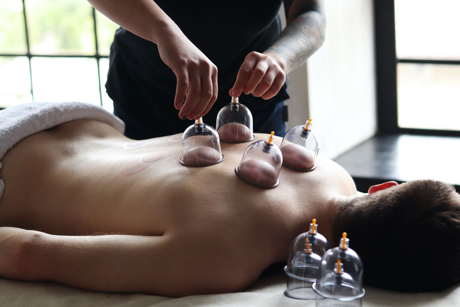 Man having a cupping therapy at Sunflower Spa