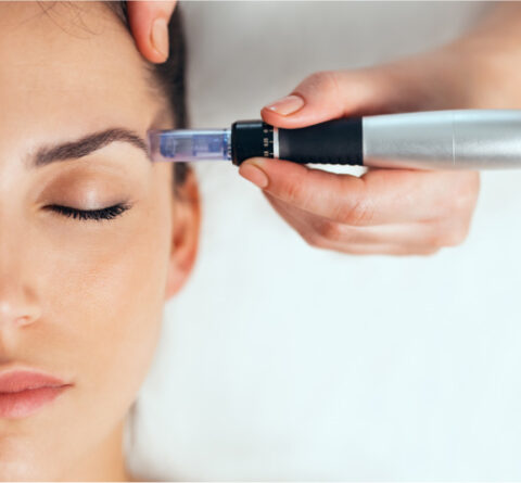 Woman getting a GeniusRF microneedling at Sunflower Spa